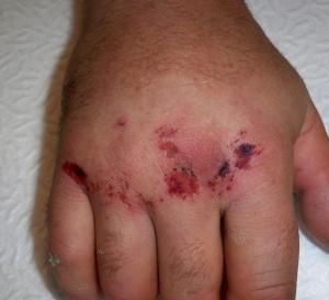 post-10573-0-47304700-1320725600_thumb.jpg